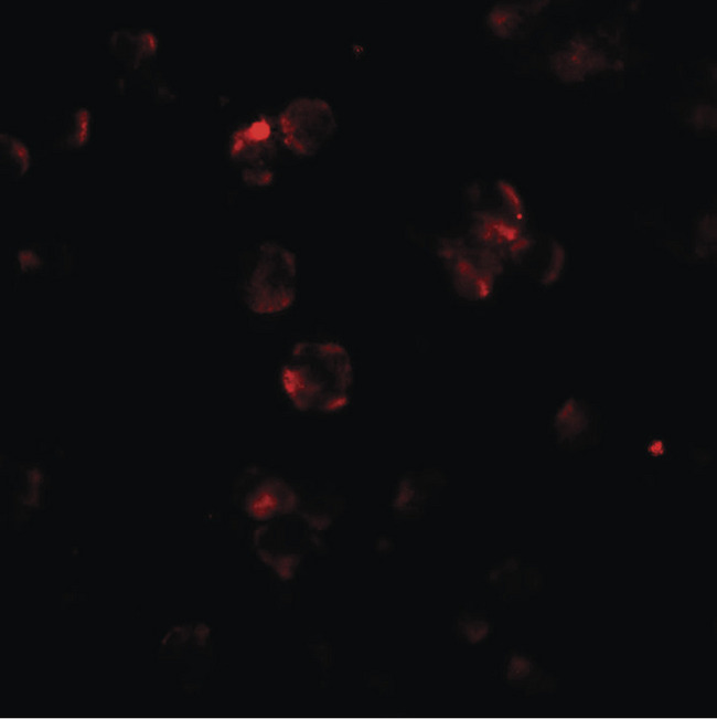 ABCA1 Antibody - Immunofluorescence of ABCA7 in 293 cells with ABCA7 antibody at 20 ug/ml.