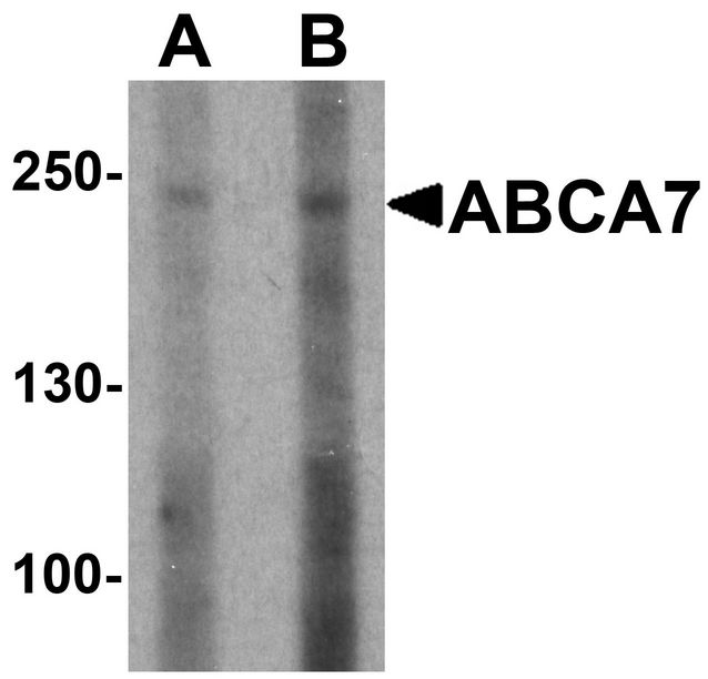 ABCA1 Antibody - Western blot analysis of ABCA7 in 293 cell lysate with ABCA7 antibody at (A) 1 and (B) 2 ug/ml.