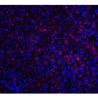 ABCA1 Antibody - Immunofluorescence of ABCA7 in human spleen tissue with ABCA7 antibody at 20 µg/ml.