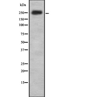 ABCA1 Antibody - Western blot analysis of ABCA1 using MCF-7 whole cells lysates