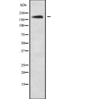 ABCA10 Antibody - Western blot analysis of ABCA10 using Jurkat whole cells lysates
