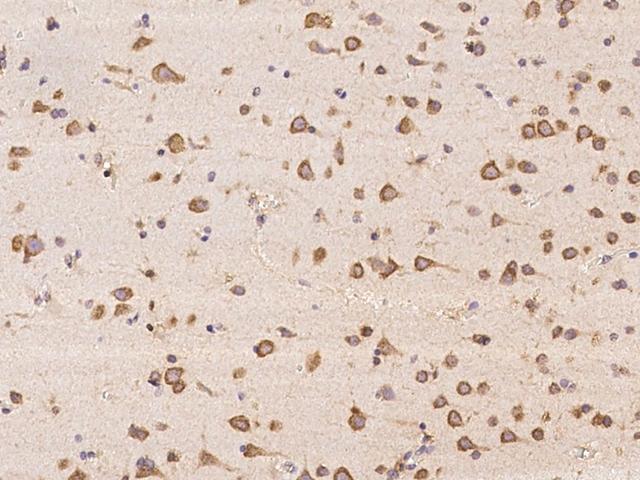 ABCA10 Antibody - Immunochemical staining of human ABCA10 in human brain with rabbit polyclonal antibody at 1:500 dilution, formalin-fixed paraffin embedded sections.