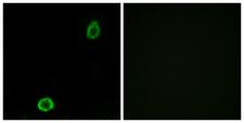 ABCA13 Antibody - Immunofluorescence analysis of A549 cells, using ABCA13 Antibody. The picture on the right is blocked with the synthesized peptide.