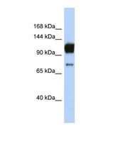 ABCA2 Antibody - Western blot of Human Jurkat. ABCA2 antibody dilution 1.0 ug/ml.  This image was taken for the unconjugated form of this product. Other forms have not been tested.