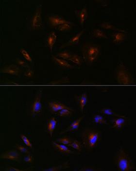 ABCA2 Antibody - Immunofluorescence analysis of U-251MG cells using ABCA2 Polyclonal Antibody at dilution of 1:100 (40x lens).Blue: DAPI for nuclear staining.