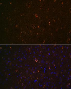ABCA2 Antibody - Immunofluorescence analysis of Mouse brain using ABCA2 Polyclonal Antibody at dilution of 1:100 (40x lens).Blue: DAPI for nuclear staining.