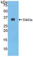 ABCA3 Antibody - Western Blot; Sample: Recombinant ABCA3, Human.