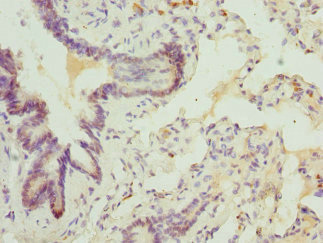 ABCA3 Antibody - Immunohistochemistry of paraffin-embedded human lung tissue at dilution 1:100