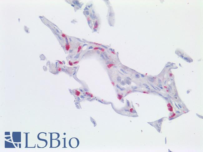 ABCA3 Antibody - Human Lung: Formalin-Fixed, Paraffin-Embedded (FFPE)