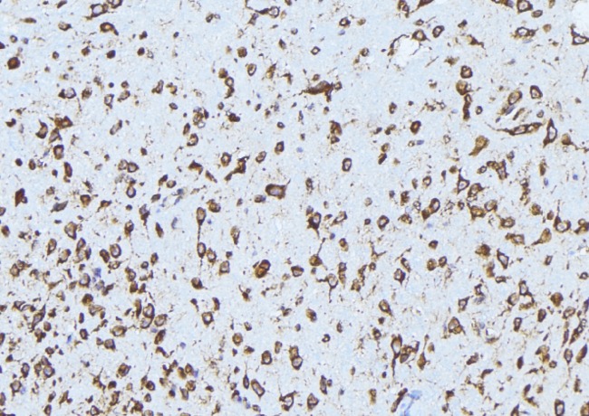 ABCA3 Antibody - 1:100 staining mouse brain tissue by IHC-P. The sample was formaldehyde fixed and a heat mediated antigen retrieval step in citrate buffer was performed. The sample was then blocked and incubated with the antibody for 1.5 hours at 22°C. An HRP conjugated goat anti-rabbit antibody was used as the secondary.