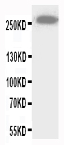 ABCA4 Antibody - WB of ABCA4 antibody. All lanes: Anti-ABCA4 at 0.5ug/ml. WB: Mouse Brain Tissue Lysate at 40ug. Predicted bind size: 256KD. Observed bind size: 256KD.