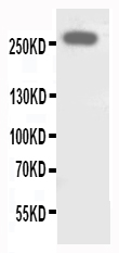 ABCA4 Antibody - WB of ABCA4 antibody. All lanes: Anti-ABCA4 at 0.5ug/ml. WB: SHG Whole Cell Lysate at 40ug. Predicted bind size: 256KD. Observed bind size: 256KD.