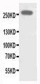 ABCA4 Antibody - WB of ABCA4 antibody. All lanes: Anti-ABCA4 at 0.5ug/ml. WB: SHG Whole Cell Lysate at 40ug. Predicted bind size: 256KD. Observed bind size: 256KD.