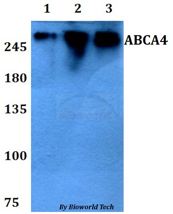 ABCA4 Antibody - Western blot of ABCA4 antibody at 1:500 dilution. Lane 1: HEK293T whole cell lysate. Lane 2: sp2/0 whole cell lysate. Lane 3: PC12 whole cell lysate.