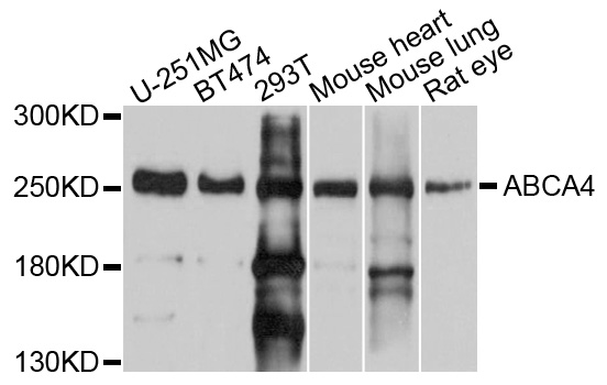 ABCA4 Antibody - Western blot analysis of extracts of various cell lines, using ABCA4 antibody at 1:1000 dilution. The secondary antibody used was an HRP Goat Anti-Rabbit IgG (H+L) at 1:10000 dilution. Lysates were loaded 25ug per lane and 3% nonfat dry milk in TBST was used for blocking. An ECL Kit was used for detection and the exposure time was 10s.