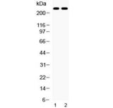 ABCA4 Antibody - Western blot testing of 1) rat eye and 2) mouse eye lysate with ABCA4 antibody at 0.5ug/ml. Predicted molecular weight ~256 kDa.