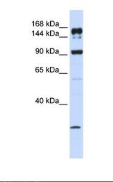 ABCA5 Antibody - MCF7 cell lysate. Antibody concentration: 1.0 ug/ml. Gel concentration: 6-18%.  This image was taken for the unconjugated form of this product. Other forms have not been tested.