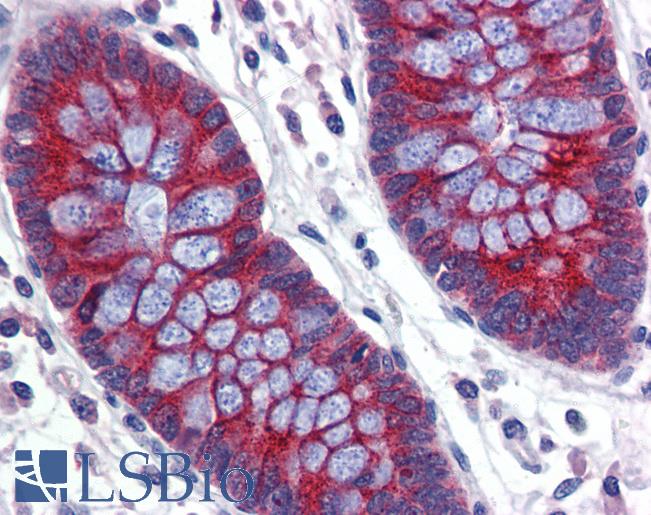 ABCA5 Antibody - Anti-ABCA5 antibody IHC of human colon. Immunohistochemistry of formalin-fixed, paraffin-embedded tissue after heat-induced antigen retrieval. Antibody concentration 5 ug/ml.  This image was taken for the unconjugated form of this product. Other forms have not been tested.