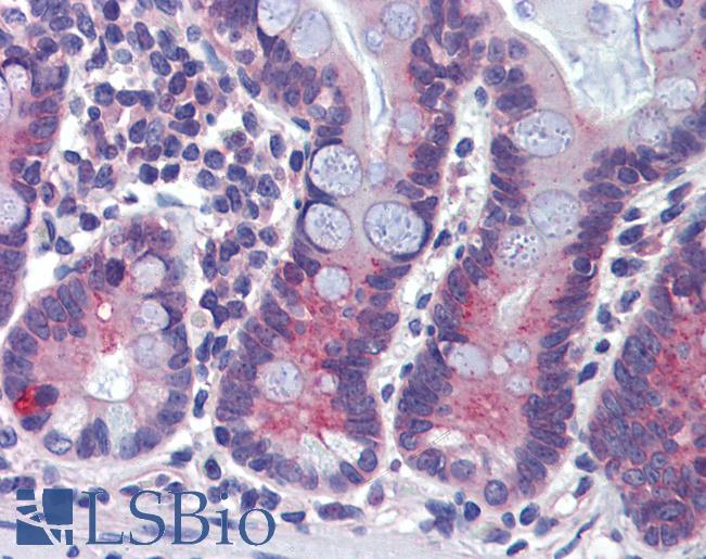 ABCA5 Antibody - Anti-ABCA5 antibody IHC of human small intestine. Immunohistochemistry of formalin-fixed, paraffin-embedded tissue after heat-induced antigen retrieval. Antibody concentration 5 ug/ml.  This image was taken for the unconjugated form of this product. Other forms have not been tested.