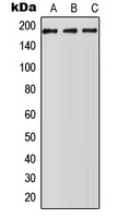 ABCA5 Antibody - Western blot analysis of ABCA5 expression in HepG2 (A); NIH3T3 (B); H9C2 (C) whole cell lysates.