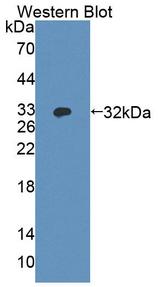 ABCA5 Antibody - Western Blot; Sample: Recombinant protein.