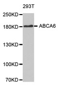 ABCA6 Antibody - Western blot analysis of extracts of 293T cellline.