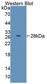 ABCA6 Antibody - Western Blot; Sample: Recombinant protein.