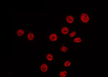 ABCA6 Antibody - Staining 293 cells by IF/ICC. The samples were fixed with PFA and permeabilized in 0.1% Triton X-100, then blocked in 10% serum for 45 min at 25°C. The primary antibody was diluted at 1:200 and incubated with the sample for 1 hour at 37°C. An Alexa Fluor 594 conjugated goat anti-rabbit IgG (H+L) Ab, diluted at 1/600, was used as the secondary antibody.