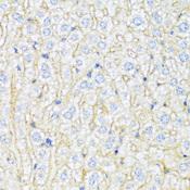 ABCA6 Antibody - Immunohistochemistry of paraffin-embedded Mouse liver using ABCA6 Polyclonal Antibody at dilution of 1:100 (40x lens).