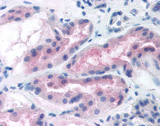 ABCA7 Antibody - Anti-ABCA7 antibody IHC of human kidney. Immunohistochemistry of formalin-fixed, paraffin-embedded tissue after heat-induced antigen retrieval. Antibody concentration 5 ug/ml.  This image was taken for the unconjugated form of this product. Other forms have not been tested.
