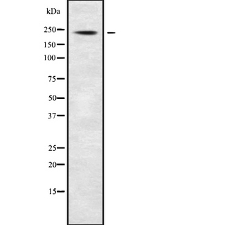 ABCA7 Antibody - Western blot analysis of ABCA7 using Jurkat whole cells lysates