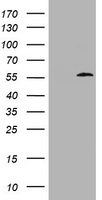 ABCB1 / MDR1 / P Glycoprotein Antibody - HEK293T cells were transfected with the pCMV6-ENTRY control (Left lane) or fragment (347-710 AA) of ABCB1 (Right lane) cDNA for 48 hrs and lysed. Equivalent amounts of cell lysates (5 ug per lane) were separated by SDS-PAGE and immunoblotted with anti-ABCB1.