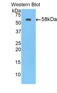 ABCB1 / MDR1 / P Glycoprotein Antibody - Western blot of recombinant PGP.