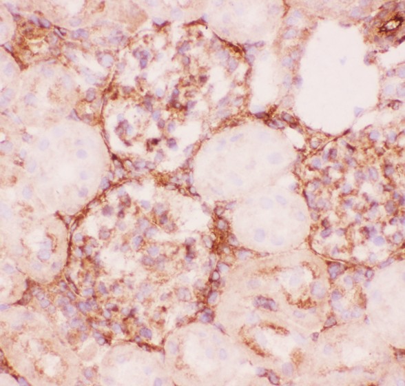 ABCB1 / MDR1 / P Glycoprotein Antibody - P Glycoprotein antibody IHC-frozen: Rat Kidney Tissue.