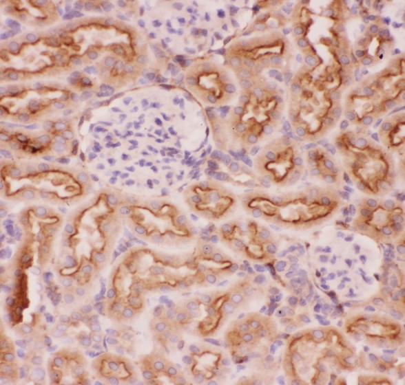 ABCB1 / MDR1 / P Glycoprotein Antibody - P Glycoprotein antibody IHC-paraffin: Rat Kidney Tissue.