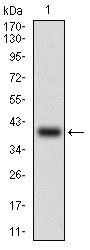 ABCB1 / MDR1 / P Glycoprotein Antibody - Western blot using ABCB1 monoclonal antibody against human ABCB1 (AA: 632-693) recombinant protein. (Expected MW is 32.4 kDa)