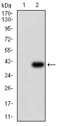 ABCB1 / MDR1 / P Glycoprotein Antibody - Western blot using ABCB1 monoclonal antibody against HEK293 (1) and ABCB1 (AA: 632-693)-hIgGFc transfected HEK293 (2) cell lysate.