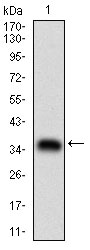 ABCB1 / MDR1 / P Glycoprotein Antibody - Western blot using ABCB1 monoclonal antibody against human ABCB1 (AA: 632-693) recombinant protein. (Expected MW is 32.4 kDa)
