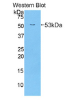 ABCB1 / MDR1 / P Glycoprotein Antibody - Western blot of recombinant ABCB1 / MDR1 / P Glycoprotein.