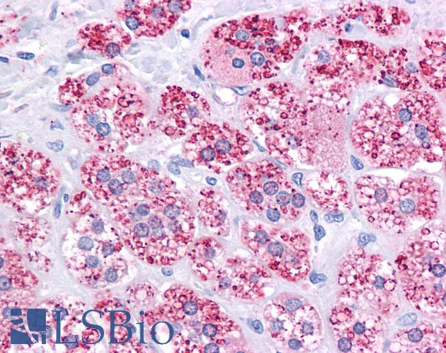 ABCB1 / MDR1 / P Glycoprotein Antibody - Anti-MDR1 antibody IHC of human adrenal. Immunohistochemistry of formalin-fixed, paraffin-embedded tissue after heat-induced antigen retrieval. Antibody concentration 10 ug/ml.
