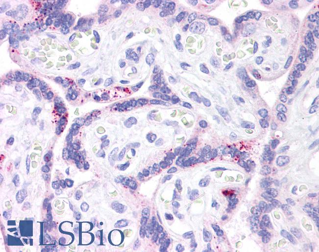 ABCB1 / MDR1 / P Glycoprotein Antibody - Anti-MDR1 antibody IHC of human placenta. Immunohistochemistry of formalin-fixed, paraffin-embedded tissue after heat-induced antigen retrieval. Antibody concentration 10 ug/ml.