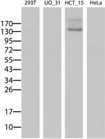 ABCB1 / MDR1 / P Glycoprotein Antibody - Western blot of extracts (15 ug) from 4 different cell lines by using anti-ABCB1 monoclonal antibody (Lane 1: 293T; Lane 2: UO_31; Lane 3: HCT_115; Lane 4: HeLa).