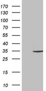 ABCB1 / MDR1 / P Glycoprotein Antibody - SF9 cells lysate. (5 ug, left lane) andcells lysate expressing human recombinant protein fragment. (5 ug, right lane) corresponding to amino acids 995-1280 of human ABCB1. (NP_000918) were separated by SDS-PAGE and immunoblotted with anti-ABCB1. (1:2000)