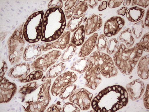 ABCB1 / MDR1 / P Glycoprotein Antibody - Immunohistochemical staining of paraffin-embedded Human Kidney tissue within the normal limits using anti-ABCB1 mouse monoclonal antibody. (Heat-induced epitope retrieval by 1 mM EDTA in 10mM Tris, pH8.5, 120C for 3min,