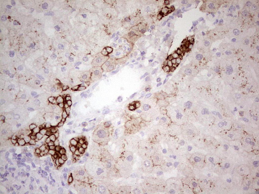 ABCB1 / MDR1 / P Glycoprotein Antibody - Immunohistochemical staining of paraffin-embedded Human liver tissue within the normal limits using anti-ABCB1 mouse monoclonal antibody. (Heat-induced epitope retrieval by 1 mM EDTA in 10mM Tris, pH8.5, 120C for 3min,