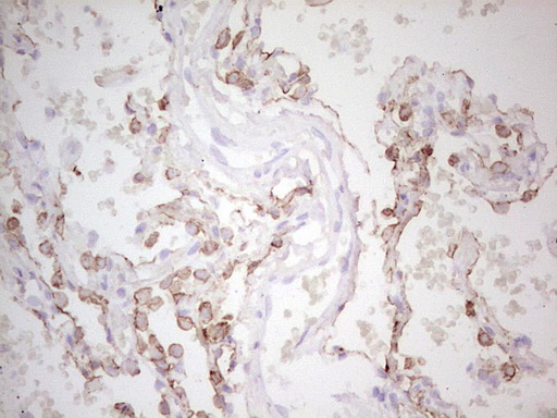 ABCB1 / MDR1 / P Glycoprotein Antibody - Immunohistochemical staining of paraffin-embedded Human lung tissue within the normal limits using anti-ABCB1 mouse monoclonal antibody. (Heat-induced epitope retrieval by 1 mM EDTA in 10mM Tris, pH8.5, 120C for 3min,