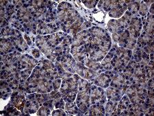 ABCB1 / MDR1 / P Glycoprotein Antibody - Immunohistochemical staining of paraffin-embedded Human pancreas tissue within the normal limits using anti-ABCB1 mouse monoclonal antibody. (Heat-induced epitope retrieval by 1mM EDTA in 10mM Tris buffer. (pH8.5) at 120°C for 3 min. (1:2000)