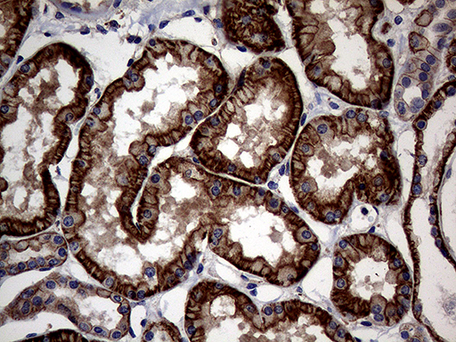 ABCB1 / MDR1 / P Glycoprotein Antibody - Immunohistochemical staining of paraffin-embedded Human Kidney tissue within the normal limits using anti-ABCB1 mouse monoclonal antibody. (Heat-induced epitope retrieval by 1mM EDTA in 10mM Tris buffer. (pH8.5) at 120°C for 3 min. (1:2000)