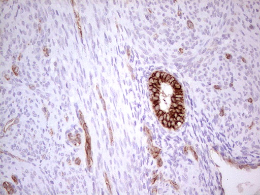 ABCB1 / MDR1 / P Glycoprotein Antibody - Immunohistochemical staining of paraffin-embedded Human endometrium tissue within the normal limits using anti-ABCB1 mouse monoclonal antibody. (Heat-induced epitope retrieval by 1 mM EDTA in 10mM Tris, pH8.5, 120C for 3min,