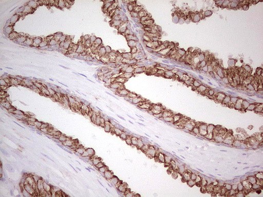 ABCB1 / MDR1 / P Glycoprotein Antibody - Immunohistochemical staining of paraffin-embedded Human prostate tissue within the normal limits using anti-ABCB1 mouse monoclonal antibody. (Heat-induced epitope retrieval by 1 mM EDTA in 10mM Tris, pH8.5, 120C for 3min,
